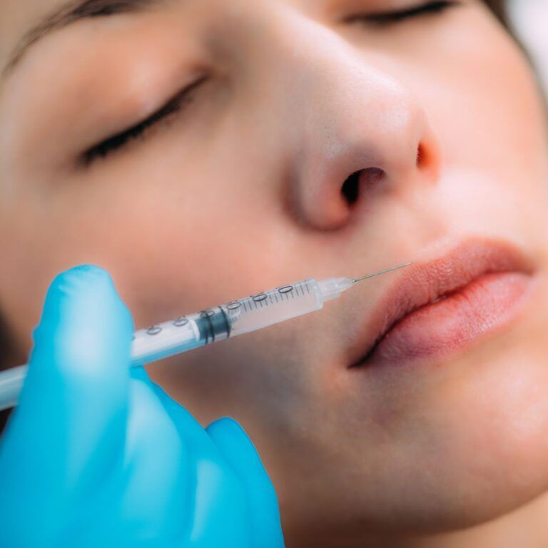 Lip injection procedure with syringe and gloved hand.