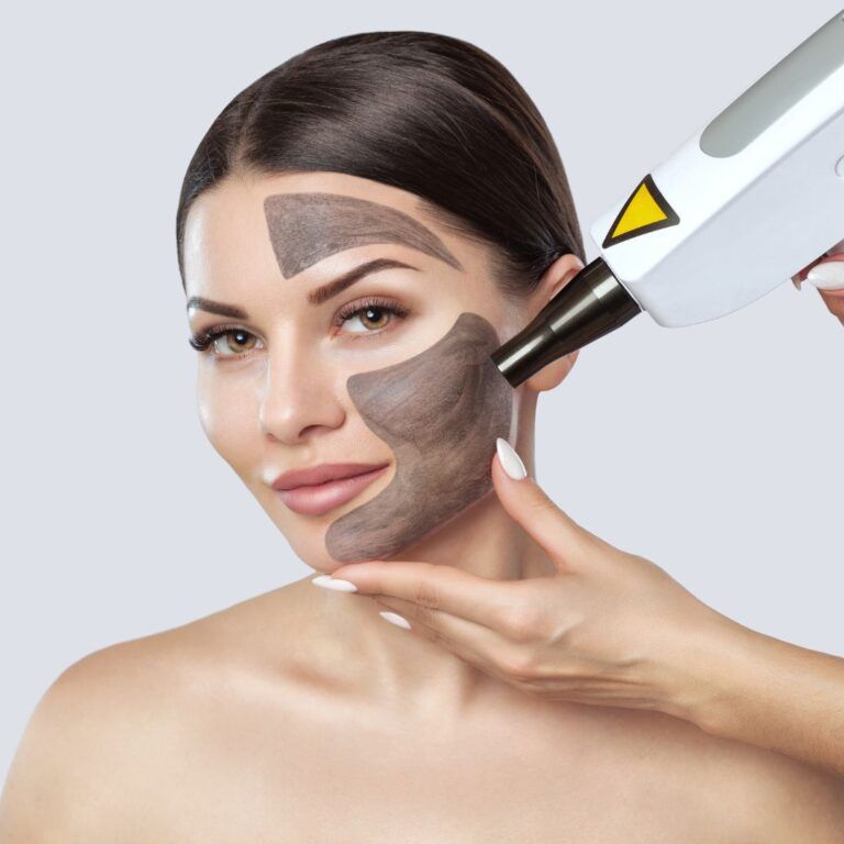 Woman receiving facial treatment with laser device.