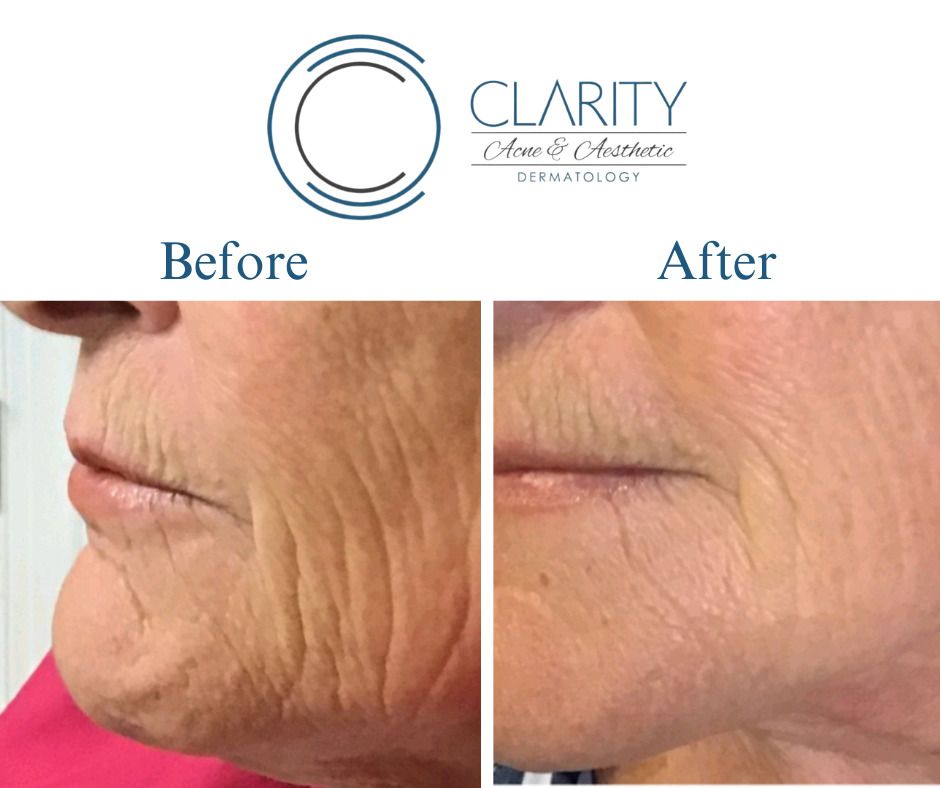 Pixel 8 Before & After