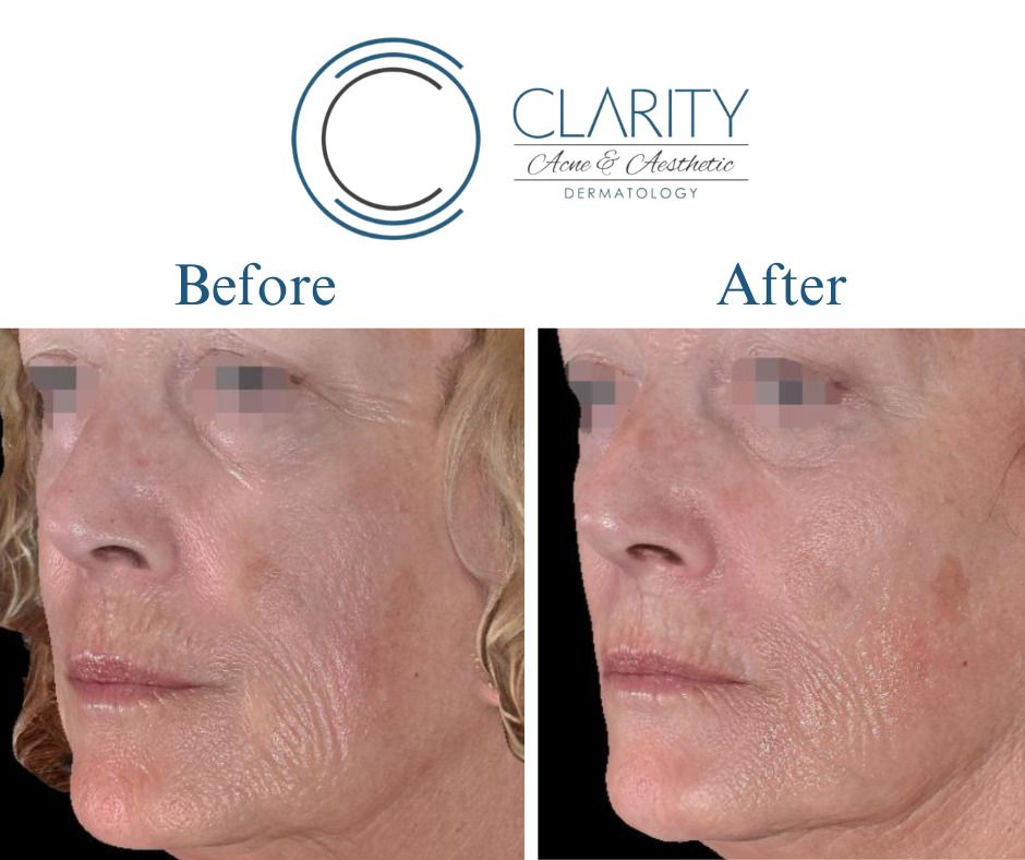 Pixel 8 Before & After