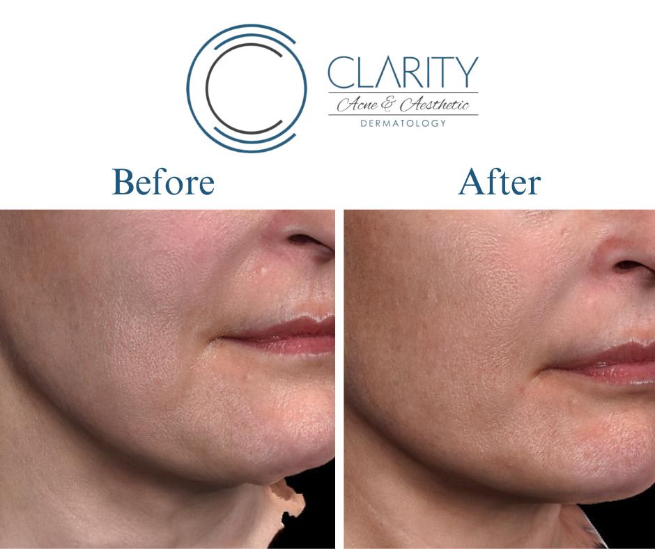 Pixel 8 Before & After